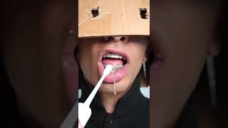 Removing buildup from braces 😳