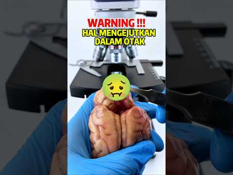 BIKIN MERINDING, ISI MENGEJUTKAN DARI BAGIAN TUBUH HEWAN
