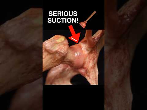 Look how STRONG the suction is of the hip labrum! #jointpain #medschool