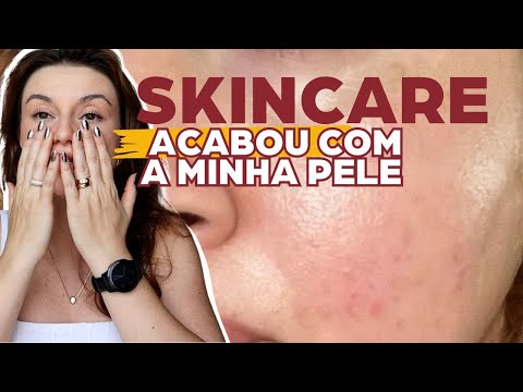 Esteticista, deu ruim, e agora? | 1EP - O skincare acabou com a minha pele