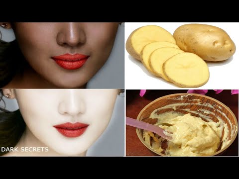 1 दिन में चेहरे के रंग को ऐसे निखार देगा / Potato for Spotless Skin