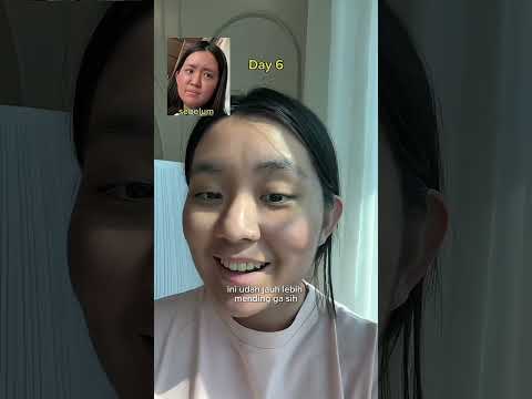 Plot twist! Dia nggak milih pacarnya… tapi ini 😭”#collagen #shopping #reels