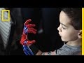Prosthetics and 3D Printing Insights