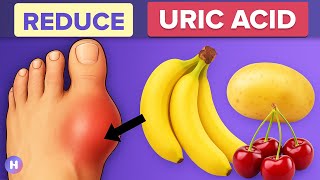 11 Foods That Reduce Your Uric Acid Levels - Backed By Research