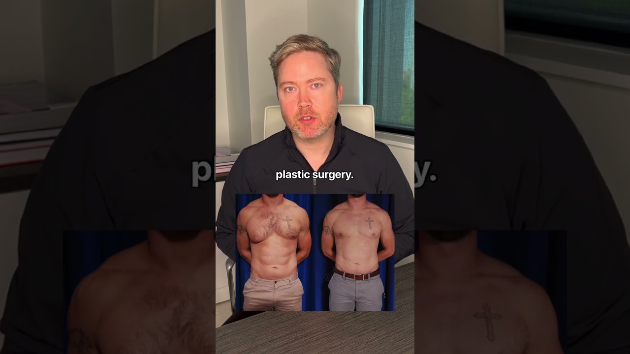 Doctor discusses plastic surgery results and techniques.
