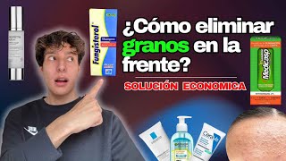 ELIMINA LAS BOLITAS Y GRANITOS DE LA FRENTE FÁCIL Y ECONOMICO