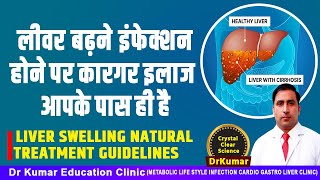 लीवर बढ़ने इंफेक्शन होने पर कारगर इलाज आपके पास ही है//LIVER SWELLING NATURAL TREATMENT GUIDELINES