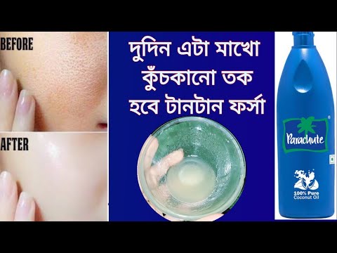 শীতের নারকোল তেলে এটা মিশিয়ে মাখো ত্বক ফর্সা উজ্জ্বল টানটান হবে কুচকানো ত্বক দূর হবে//Glowing skin