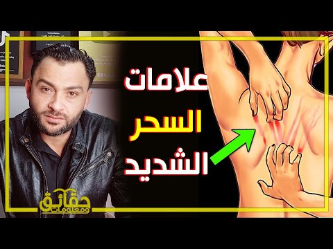 ماهي علامات السحر الشديد؟!