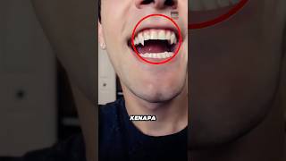 Kenapa ada orang yang memiliki gigi vampir😱