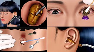 ASMR Satisfying Care Animation‼️ Ear Cleaning, Navel stone & Big Snot Removal, Piercing, Make up