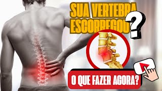 SUA VÉRTEBRA ESCORREGOU? Saiba o Que Fazer e Quais Exercícios Ajudam na Espondilolistese