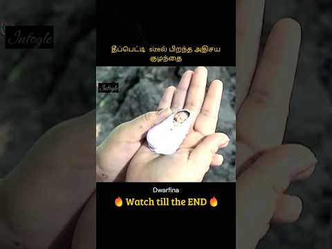 Miraculous baby born in the size of a matchbox | தீப்பெட்டி  sizeல் பிறந்த அதிசய குழந்தை | Infogle