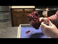 Heart Anatomy and Function Assessment