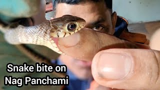 सांप को उंगली करने से क्या होता है देखिए स्नेक बाइटWhat happens if you finger a snake See snake bite