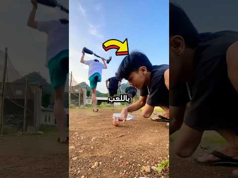 مقلب القدم الصناعية😳عندما تتحول الإعاقة إلى لحظة مرح!