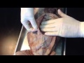 Muscle Anatomy and Functions Assessment