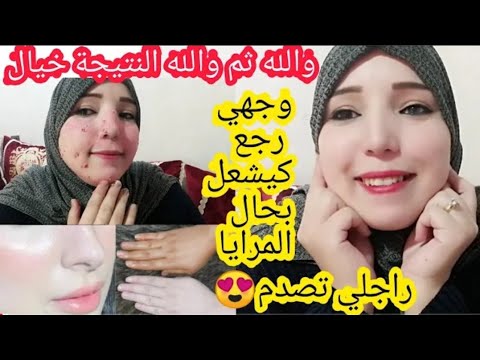 أقسم بالله وأتحمل مسؤولية ماأقول هادي أقوى وصفة لتبييض الوجه والجسم/سيري اختي لهلا يحرق فيك عظم😳