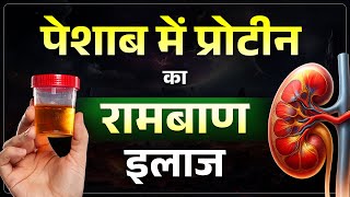 पेशाब में प्रोटीन आना (Proteinuria) - कारण, लक्षण और इलाज | Protein in Urine Symptoms & Treatment