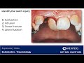 Tooth Injury Identification and Treatment