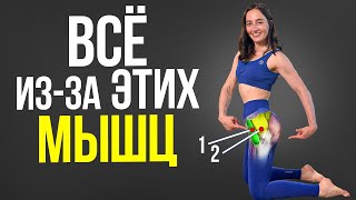 Коксартроз, боли в тазобедренном суставе, коленях, пояснице и всё из-за ЭТИХ 2-х мышц
