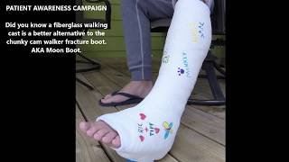 Walking boot vs Cast - Orthopedic Cam Boot for Broken Boot -  comparing short leg walking cast