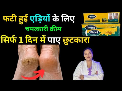 Pheet Cracked Heel Balm | सिर्फ 1 दिन में फटी हुई एड़ियों से पाए छुटकारा | Detailed Product Review