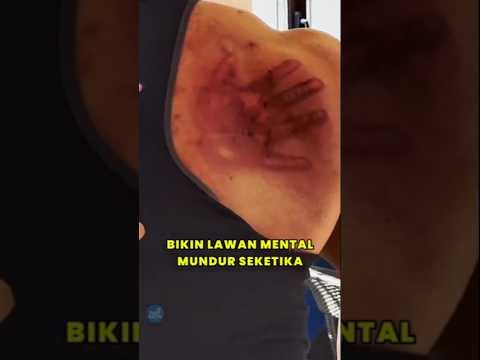 Bukan Kungfu Biasa Ini Dia Tongbeiquan