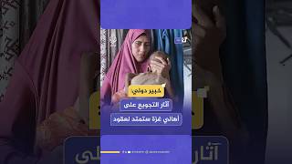 خبير دولي يكشف أضرارا بعيدة المدى تهدد الصغار والكبار في قطاع غزة بسبب المجاعة