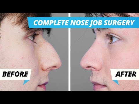 austinplasticsurgeon In the video we posted recently we had a lot of