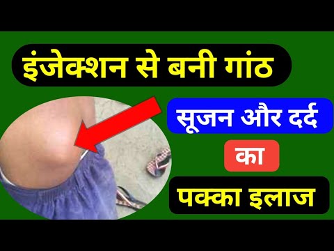 इंजेक्शन की गांठ दर्द सूजन 3 दिन में ठीक | Thrombotas Ointment | Thrombophob Ointment Uses in Hindi 