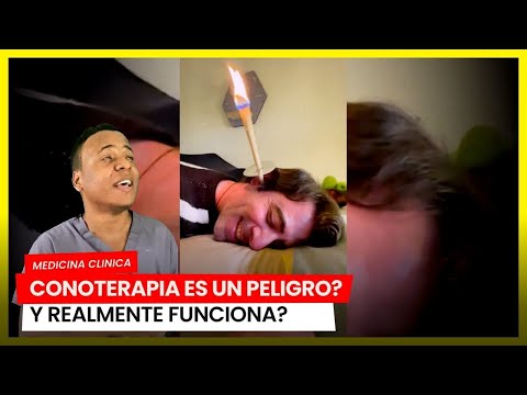 ¡FUNCIONA La Conoterapia o Terapia Termo auricular 👂!