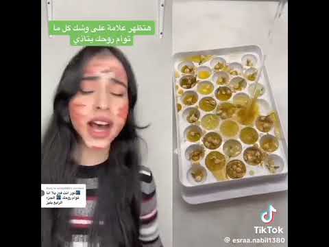 اسراء انت اتجننتي ايه اللي في وشك ده يا اسراء #قصص