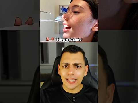 COISAS ESTRANHAS ENCONTRADAS DENTRO DE PESSOAS!! 😱