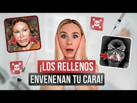 ¡No ponga fillers hasta que veas este video! Los rellenos faciales - Verdad y Mentira!