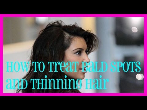 How to Treat Bald Spots and Thinning Hair