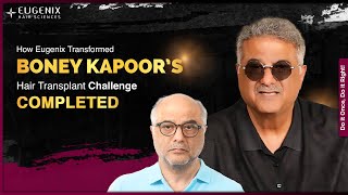 Boney Kapoor Hair Transplant SUCCESS | From Bald to Bold Transformation Results