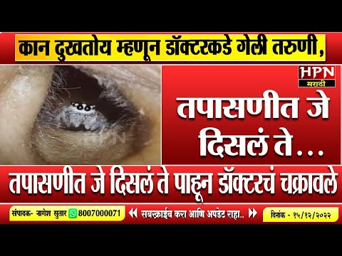 कान दुखतोय म्हणून डॉक्टरकडे गेली तरुणी,तपासणीत जे दिसलं ते... | Viral Video | Hpn Marathi News