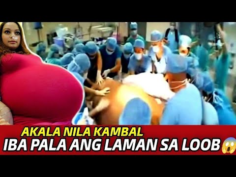 AKALA NYA MAGKAROON NA SYA NG KAMBAL, NAGULAT ANG DOCTOR IBA ANG LUAMBAS