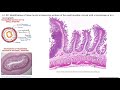 Intestinal Function and Absorption