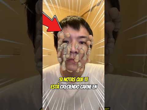 Si ves a alguien así, corre de inmediato 😭😱