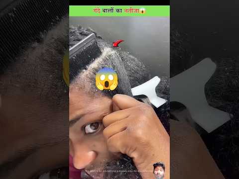 इसे अपने बालों से तुरंत हटाएं😱 #hair #haircare #hairstyle #facts #haircut #3danimation #viralshorts