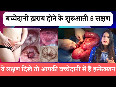 Bachedani me dard kyu hota hai | Pain in uterus area in hindi | Bachedani me dard ho to kya kare