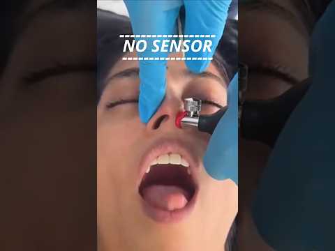 Dimasukkan sampai mulut, balon atasi hidung tersumbat #flu #pilek #unik #aneh #adaadaaja