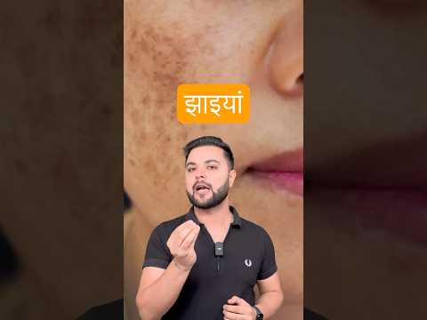 Best Sunscreen for Oily Skin: Pigmentation, Melasma, झाइयाँ Treatment Routine