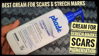 Cream For Strech Marks | Phade Strech Marks Cream | Cream For Scars | Shruti Mishra