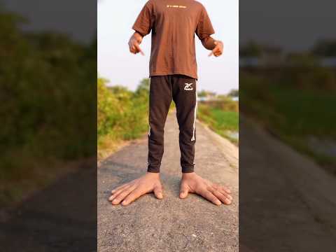 Can You Walk Without Legs? 🦶