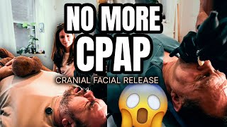 He Flew 14 Hours for the Face Crack, And Brought His Uncle Too!