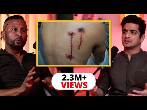 When A Bullet First Enters Your Body - Soldier Describes What It Feels Like