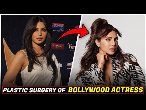 Top Bollywood Actresses With Plastic Surgery | Bollywood Plastic Surgery Before and After